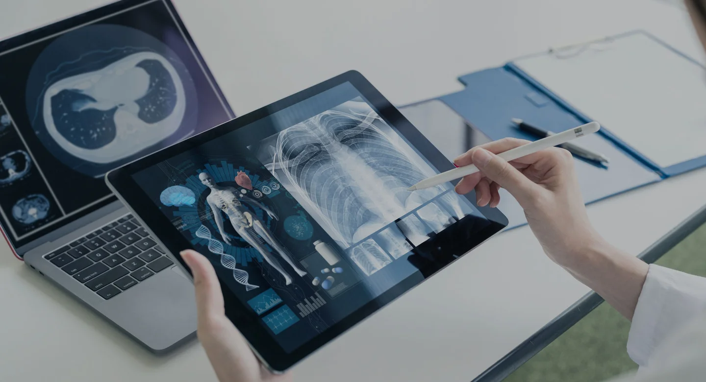 A person holding a stylus points at chest X-rays on a tablet, with a laptop displaying a CT scan nearby.